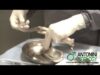 Gabriele Antonini – Impianto protesi del pene – www.antoniniurology.com (HQ)