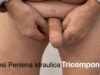 Protesi peniena idraulica tricomponente. Attivazione e disattivazione protesi peniena