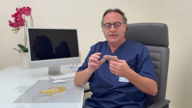 Come sarà il glande dopo la Protesi Peniena (aspetto Post-Impianto)