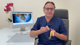 Dolore unilaterale pene dopo protesi peniena cause normali (Post-Op)