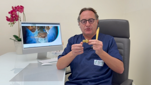 Pompa scroto palpabile sotto pelle protesi massaggi + Cycling